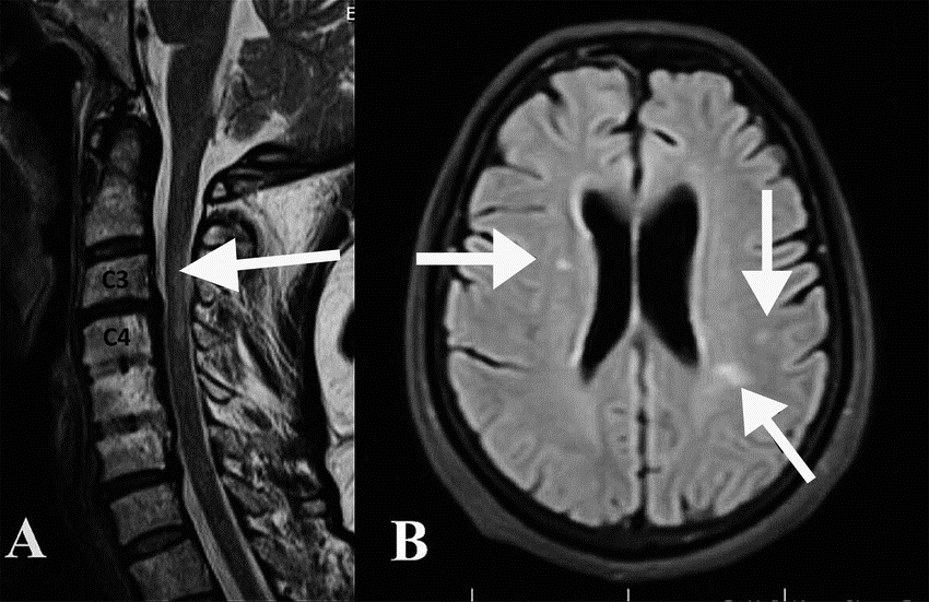 11 (u tekstu Slika 7.)